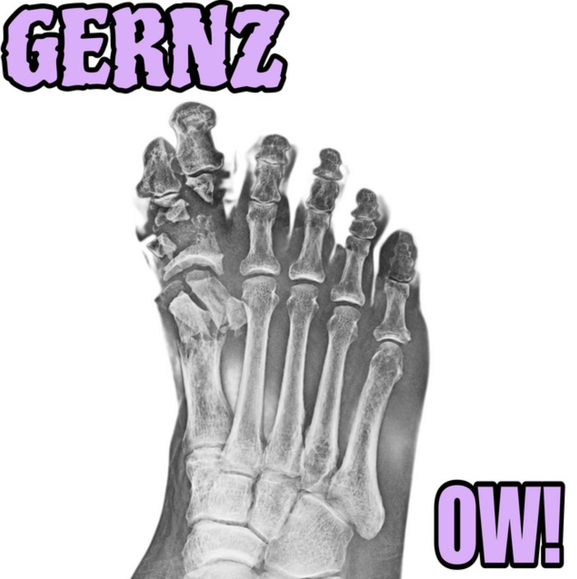 Single artwork for Gernz's track OW! featuring an X-ray scan of a human foot with bold pink title text on a white background.